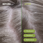 SCALP RELIEF DUO - Shampoo and Conditioner Set
