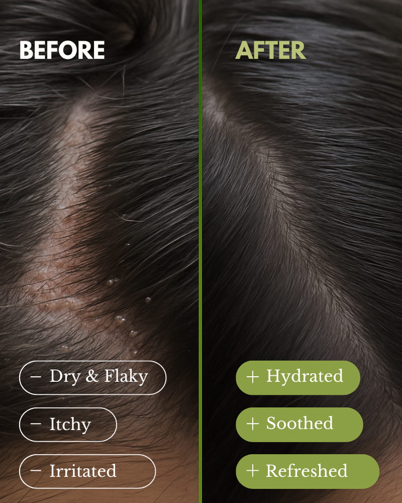 SCALP RELIEF DUO - Shampoo and Conditioner Set